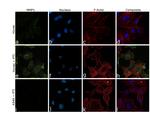 MMP1 Antibody in Immunocytochemistry (ICC/IF)