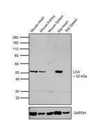 LOX Antibody in Western Blot (WB)