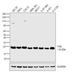 VHL Antibody in Western Blot (WB)