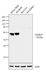 CaMKIV Antibody in Western Blot (WB)