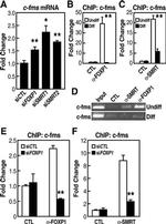 NCoR2 Antibody in ChIP Assay (ChIP)