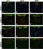 HDAC1 Antibody in Immunohistochemistry (IHC)