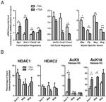 HDAC1 Antibody in ChIP Assay (ChIP)