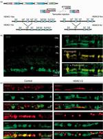 HDAC1 Antibody in Immunohistochemistry (Paraffin) (IHC (P))