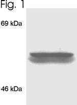 FKBP4 Antibody in Western Blot (WB)