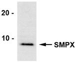 SMPX Antibody in Western Blot (WB)