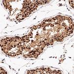 NBS1 Antibody in Immunohistochemistry (Paraffin) (IHC (P))