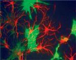 alpha Internexin Antibody in Immunocytochemistry (ICC/IF)