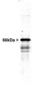 alpha Internexin Antibody in Western Blot (WB)