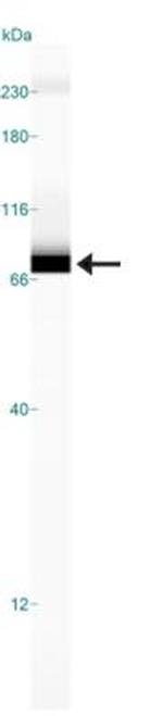 ABCF2 Antibody in Western Blot (WB)