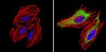 CXCR4 Antibody in Immunocytochemistry (ICC/IF)