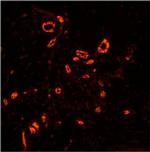 TACR1 Antibody in Immunohistochemistry (Paraffin) (IHC (P))