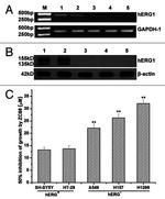 KCNH2 Antibody in Western Blot (WB)