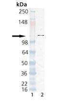 PARP1 Antibody in Western Blot (WB)