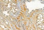 Kindlin 2 Antibody in Immunohistochemistry (Paraffin) (IHC (P))