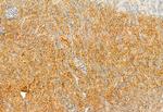 Kindlin 2 Antibody in Immunohistochemistry (Paraffin) (IHC (P))