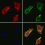 OXCT1 Antibody in Immunocytochemistry (ICC/IF)