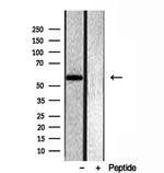 OXCT1 Antibody in Western Blot (WB)