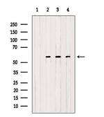 OXCT1 Antibody in Western Blot (WB)