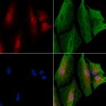 SPOP Antibody in Immunocytochemistry (ICC/IF)