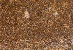 SPOP Antibody in Immunohistochemistry (Paraffin) (IHC (P))