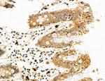 PYGL Antibody in Immunohistochemistry (Paraffin) (IHC (P))