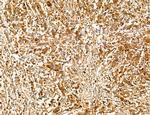 PYGL Antibody in Immunohistochemistry (Paraffin) (IHC (P))