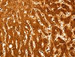 PYGL Antibody in Immunohistochemistry (Paraffin) (IHC (P))