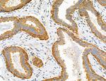 PYGL Antibody in Immunohistochemistry (Paraffin) (IHC (P))