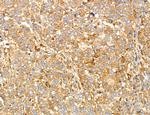 PYGL Antibody in Immunohistochemistry (Paraffin) (IHC (P))