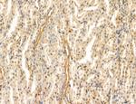 PYGL Antibody in Immunohistochemistry (Paraffin) (IHC (P))