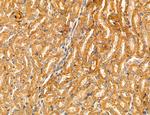 PYGL Antibody in Immunohistochemistry (Paraffin) (IHC (P))