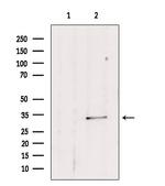 SULT1E1 Antibody in Western Blot (WB)