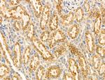 Clathrin Light Chain Antibody in Immunohistochemistry (Paraffin) (IHC (P))