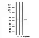 Clathrin Light Chain Antibody in Western Blot (WB)