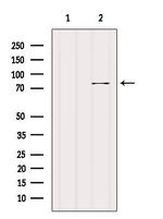 CPT1C Antibody in Western Blot (WB)