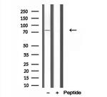 CPT1C Antibody in Western Blot (WB)
