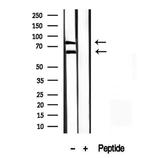 Melanophilin Antibody in Western Blot (WB)