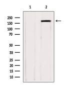 ZCCHC11 Antibody in Western Blot (WB)