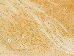 HRD1 Antibody in Immunohistochemistry (Paraffin) (IHC (P))