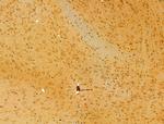 HRD1 Antibody in Immunohistochemistry (Paraffin) (IHC (P))