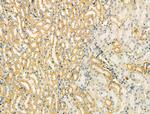 TOMM40 Antibody in Immunohistochemistry (Paraffin) (IHC (P))