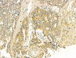 TOMM40 Antibody in Immunohistochemistry (Paraffin) (IHC (P))