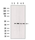 TOMM40 Antibody in Western Blot (WB)