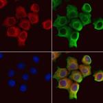 SRP14 Antibody in Immunocytochemistry (ICC/IF)