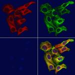 DIO1 Antibody in Immunocytochemistry (ICC/IF)