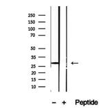 DIO1 Antibody in Western Blot (WB)