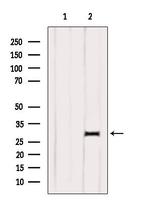 DIO1 Antibody in Western Blot (WB)