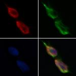 SLC39A6 Antibody in Immunocytochemistry (ICC/IF)