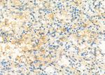 SLC39A6 Antibody in Immunohistochemistry (Paraffin) (IHC (P))